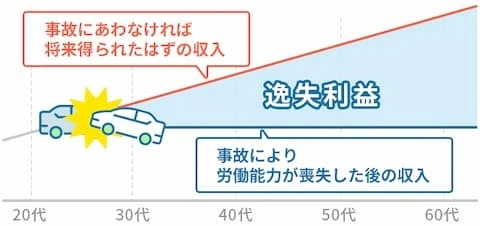 逸失利益とは？イメージ画像